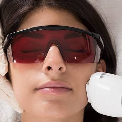 Laser Hair Removal Cheeks
