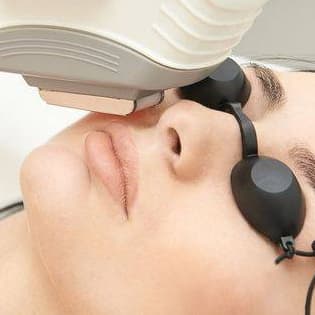 Laser Hair Removal Upper Lips